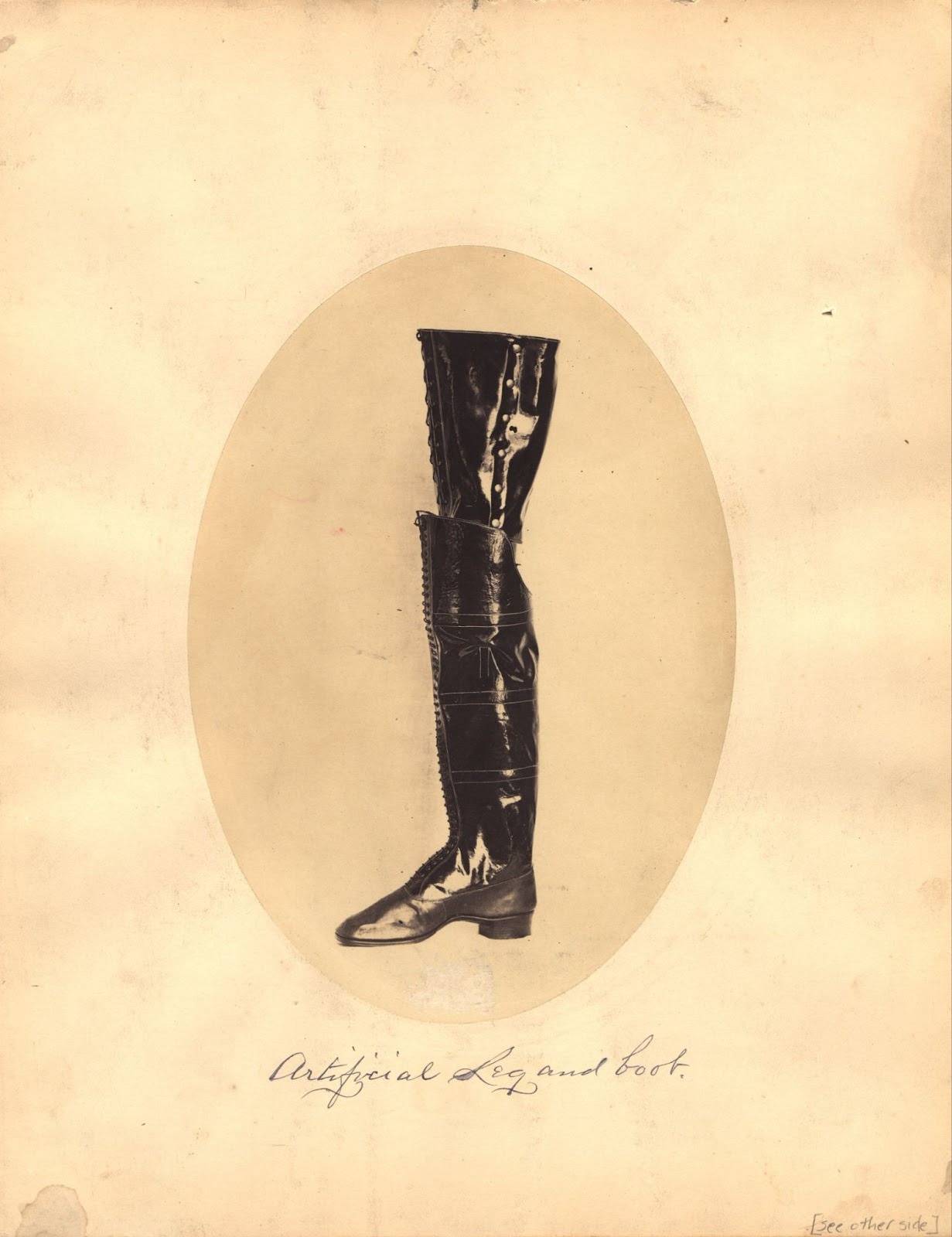 Early leg prosthetic which is a full size boot